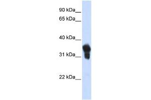 Image no. 1 for anti-MAX-Like Protein X (MLX) (N-Term) antibody (ABIN2777934)