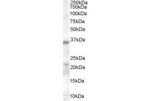 Image no. 2 for anti-Hepatitis A Virus Cellular Receptor 2 (TIM 3) (Internal Region) antibody (ABIN185571)