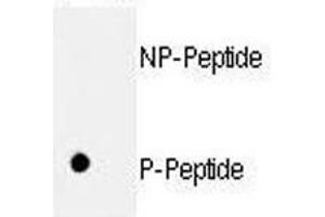 Image no. 2 for anti-Retinoblastoma Protein (Rb Protein) (pSer811) antibody (ABIN3029756)
