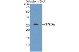 Image no. 1 for anti-Pancreatic Lipase (PNLIP) (AA 201-412) antibody (ABIN1859668)