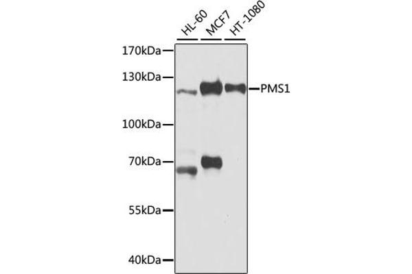 PMS1 Antikörper  (AA 405-619)