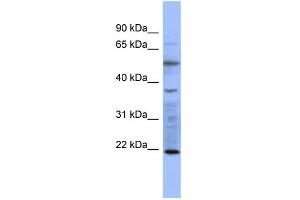 Image no. 1 for anti-Myosin, Light Chain 3 (MYL3) (N-Term) antibody (ABIN2776778)