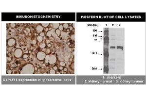 Image no. 1 for anti-Cytochrome P450, Family 4, Subfamily F, Polypeptide 11 (CYP4F11) (C-Term) antibody (ABIN264503)