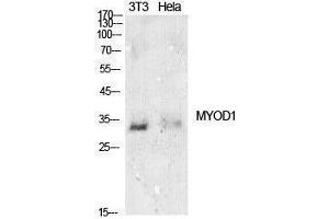 anti-Myogenic Differentiation 1 (MYOD1) (Internal Region) antibody