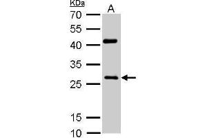 Image no. 1 for anti-NAD(P)H Dehydrogenase, Quinone 1 (NQO1) (C-Term) antibody (ABIN2854666)