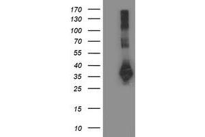 Image no. 5 for anti-Sirtuin 5 (SIRT5) antibody (ABIN1500928)