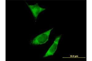 Image no. 2 for anti-Regulatory Associated Protein of mTOR, Complex 1 (RPTOR) (AA 1-379) antibody (ABIN1327629)