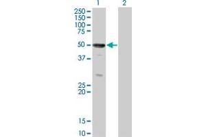 Image no. 1 for anti-Suppressor of Cytokine Signaling 4 (SOCS4) (AA 1-440) antibody (ABIN530492)