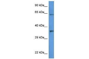 Image no. 1 for anti-Cathepsin L2 (CTSL2) (C-Term) antibody (ABIN926705)