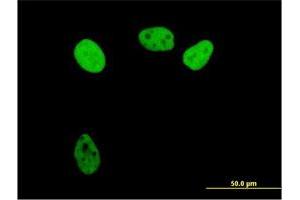 Image no. 3 for anti-Replication Protein A1, 70kDa (RPA1) (AA 1-616) antibody (ABIN948414)
