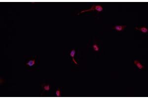 Image no. 1 for anti-Heterogeneous Nuclear Ribonucleoprotein M (HNRNPM) antibody (ABIN6262325)