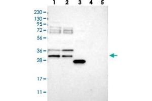 Image no. 1 for anti-RNA Binding Motif Protein 7 (RBM7) antibody (ABIN5586856)