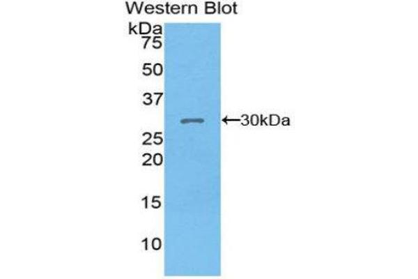 PDK1 anticorps  (AA 172-399)