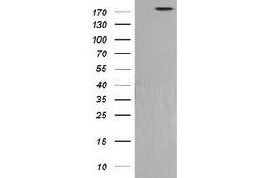 Image no. 4 for anti-Phosphatidylinositol-4-Phosphate 3-Kinase, Catalytic Subunit Type 2 beta (PIK3C2B) antibody (ABIN1500198)