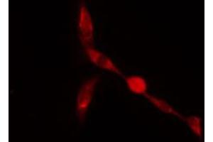 Image no. 2 for anti-Zinc Finger Protein 36, C3H Type-Like 2 (ZFP36L2) (Internal Region) antibody (ABIN6259621)