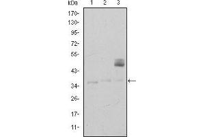 Image no. 4 for anti-CD1a (CD1a) antibody (ABIN969017)