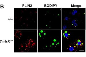 Image no. 7 for anti-Perilipin 2 (PLIN2) (AA 1-29), (N-Term) antibody (ABIN285650)