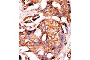 Image no. 1 for anti-Guanylate Cyclase 1 Soluble Subunit Alpha (GUCY1A1) (N-Term) antibody (ABIN359277)