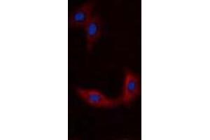 Image no. 2 for anti-BMX Non-Receptor Tyrosine Kinase (BMX) (N-Term) antibody (KLH) (ABIN2971381)
