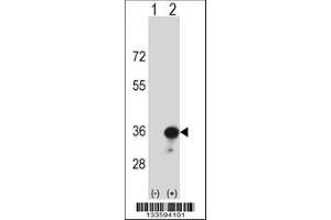 Image no. 1 for anti-Major Histocompatibility Complex, Class II, DR beta 4 (HLA-DRB4) (AA 43-72), (N-Term) antibody (ABIN657613)