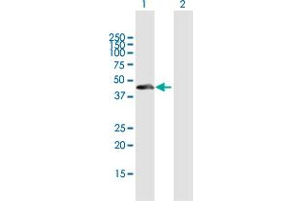 anti-THAP Domain Containing 11 (THAP11) (AA 1-314) antibody