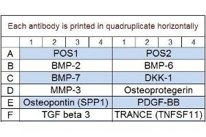 Human Bone Metabolism Array Q2 Abin