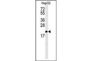 Image no. 1 for anti-S100 Calcium Binding Protein Z (S100Z) (AA 6-36), (N-Term) antibody (ABIN954659)
