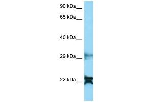 Image no. 1 for anti-NADH Dehydrogenase (Ubiquinone) 1 alpha Subcomplex, 8, 19kDa (NDUFA8) (N-Term) antibody (ABIN2789137)