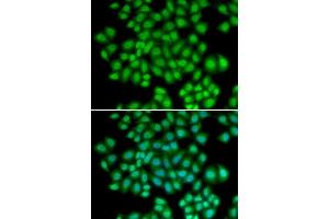 Image no. 3 for anti-Activating Transcription Factor 2 (ATF2) antibody (ABIN3023064)