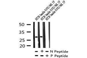 Image no. 3 for anti-Activating Transcription Factor 1 (AFT1) (pSer198) antibody (ABIN6269917)