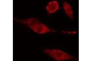 Image no. 3 for anti-WEE1 Homolog 2 (S. Pombe) (WEE2) antibody (ABIN6259536)