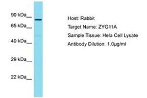 Image no. 1 for anti-Zyg-11 Family Member A, Cell Cycle Regulator (ZYG11A) (AA 500-549) antibody (ABIN6750818)