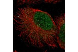 Image no. 1 for anti-Zinc Finger Protein 777 (ZNF777) antibody (ABIN5591456)