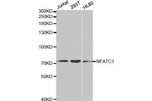 NFATC1 抗体  (AA 20-300)