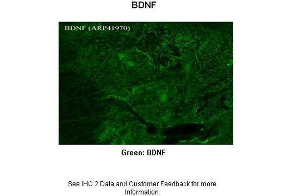 anti-Brain-Derived Neurotrophic Factor (BDNF) (Middle Region) antibody