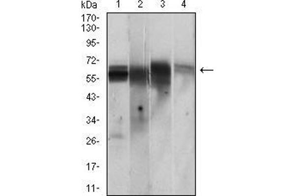 CAMKII gamma Antikörper  (AA 322-481)