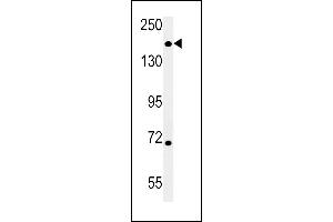 DIS3L anticorps  (N-Term)