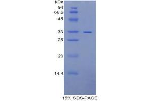 Image no. 1 for Pitrilysin Metallopeptidase 1 (PITRM1) protein (ABIN3011183)