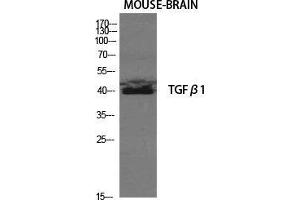 Image no. 3 for anti-Transforming Growth Factor, beta 1 (TGFB1) (C-Term) antibody (ABIN3187249)