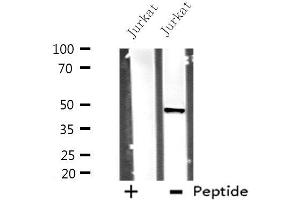 Image no. 3 for anti-Dihydroorotate Dehydrogenase (DHODH) (Internal Region) antibody (ABIN6259034)