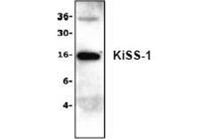 Image no. 1 for anti-KiSS-1 Metastasis-Suppressor (KISS1) (N-Term) antibody (ABIN127218)