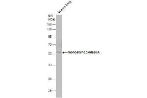 WB Image monoamine oxidase A antibody [N2C3] detects monoamine oxidase A protein by western blot analysis.