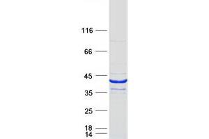 Image no. 1 for BCL2-Like 14 (Apoptosis Facilitator) (BCL2L14) (Transcript Variant 1) protein (Myc-DYKDDDDK Tag) (ABIN2715196)