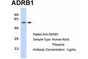 Image no. 1 for anti-Adrenergic, beta-1-, Receptor (ADRB1) (Middle Region) antibody (ABIN2774823)