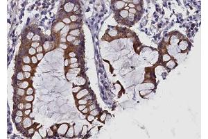 Image no. 1 for anti-Met Proto-Oncogene (MET) (Internal Region) antibody (ABIN6260340)