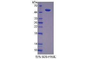 Image no. 1 for Src Kinase Associated phosphoprotein 1 (SKAP1) (AA 1-355) protein (His tag) (ABIN6239208)
