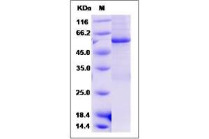 Image no. 1 for Cyclin-Dependent Kinase 1 (CDK1) (AA 1-297) protein (GST tag,His tag) (ABIN2215331)