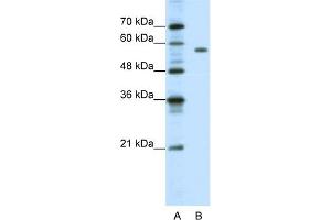 Image no. 1 for anti-Pre-B-Cell Leukemia Homeobox Protein 2 (PBX2) (C-Term) antibody (ABIN2780441)