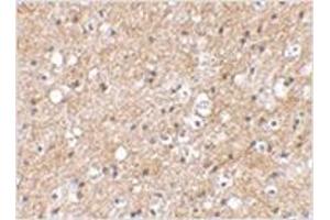 Image no. 1 for anti-SP110 Nuclear Body Protein (SP110) (C-Term) antibody (ABIN783558)