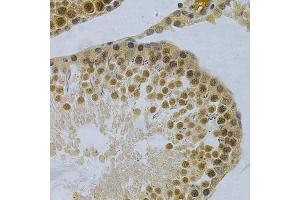 Image no. 19 for anti-ELAV (Embryonic Lethal, Abnormal Vision, Drosophila)-Like 1 (Hu Antigen R) (ELAVL1) antibody (ABIN3022231)